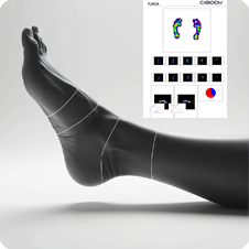 Ayak Analiz Raporu ve Basınç Haritası